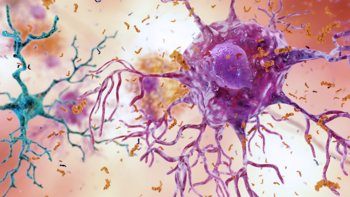 An illustration of a brain cell with signs of inflammation.