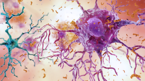 An illustration of a brain cell with signs of inflammation.